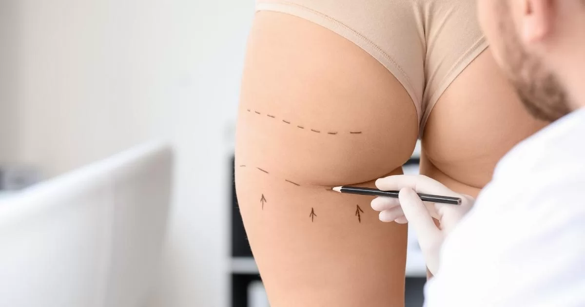 What Makes the Best Aesthetic Clinic in Dubai Stand Out for Butt Fillers