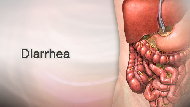 diarrhea